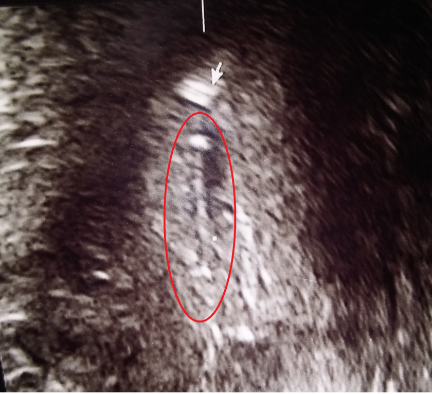 ultrasound-closeup